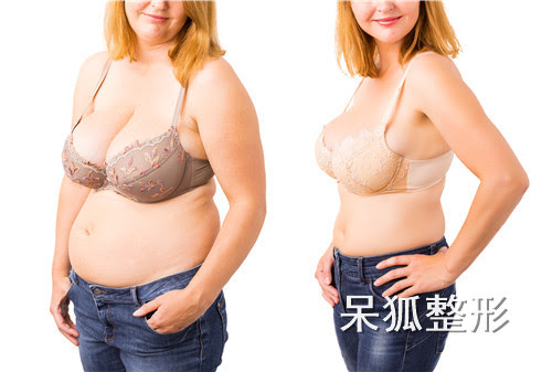 女生拥有马甲线到底是健康的吗 练马甲线对身体有好处吗 图 呆狐整形