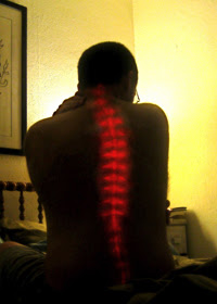  Diseases of the spine  