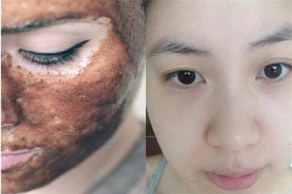 Da trắng bóc, sạch tế bào chết chỉ với 1 muỗng đường nâu