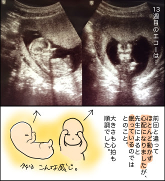 妊婦生活レポ エコーまとめ 妊娠13週 17週 21週 ちびお日記