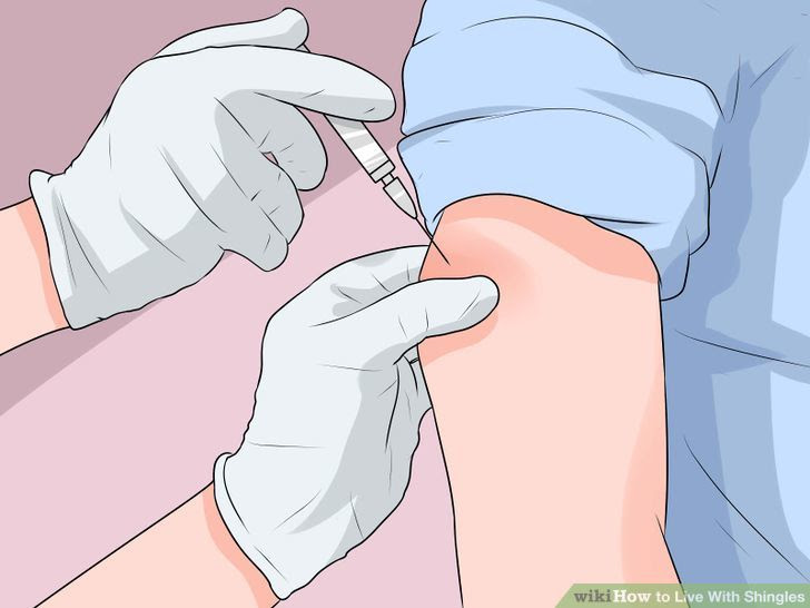 Live With Shingles Step 11.jpg