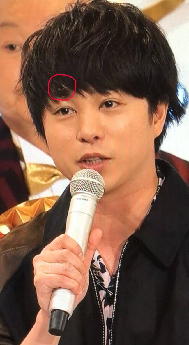 嵐 櫻井翔が紅白のリハで舞台から落ちて怪我 額の絆創膏 目の異変の謎が判明 ジャニーズtwitterまとめ