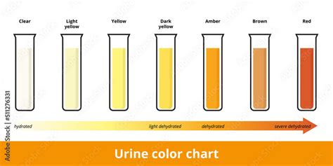 Webdec 15, 2023 · pale or transparent yellow urine is typically a sign that a person is hydrated and drinking enough water. urine color chart pee hydration and dehydration test strip urine in
