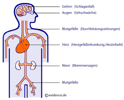Bluthochdruck Hypertonie Erhohter Blutdruck Www Patientenleitlinien De