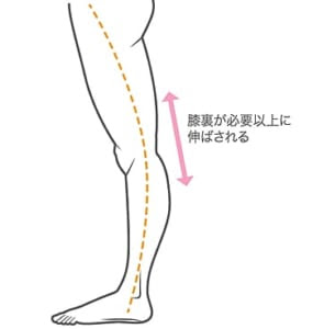 膝裏が痛い原因と対処法を医師が解説 実際の質問への返答も公開 ひざ痛チャンネル