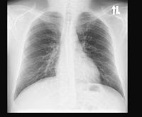 X Ray Wikis The Full Wiki