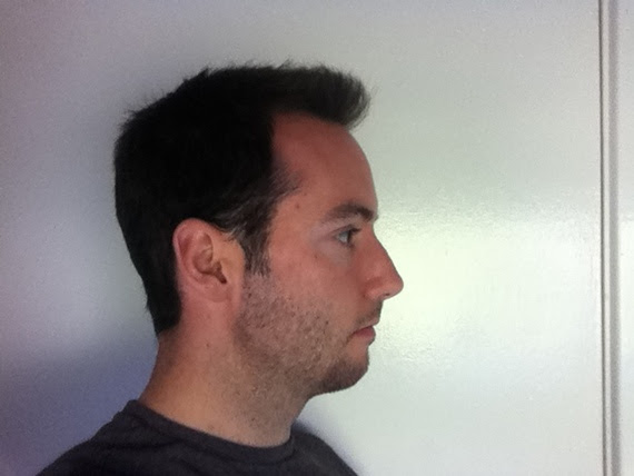 Small chin, weak jawstyle/neckline advice Beard Board Small chin, weak jawstyle/neckline advice Beard Board