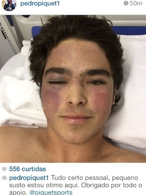 Pedro Piquet posta foto após acidente e agradece apoio, em Goiás (Foto: Reprodução/Instagram)