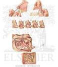 EPISTAXIS - Netter Medical Illustrations