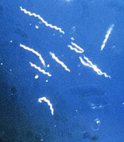Borrelia bacteria, the causative agent of Lyme disease. Magnified 400 times.