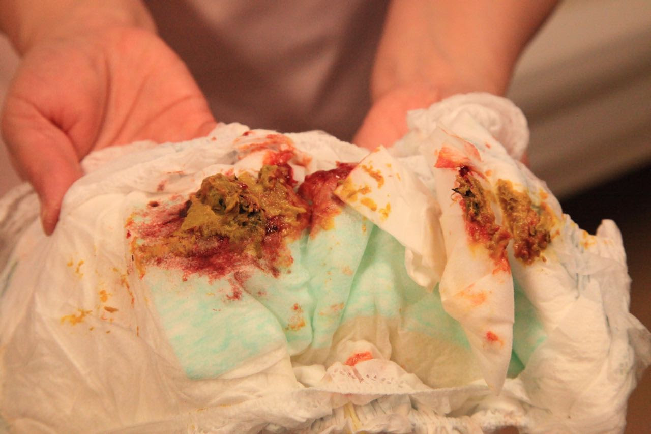 大腸菌等による感染性腸炎にご注意を 診療案内 堀こどもクリニック
