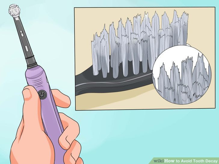 Avoid Tooth Decay Step 2 Version 2.jpg