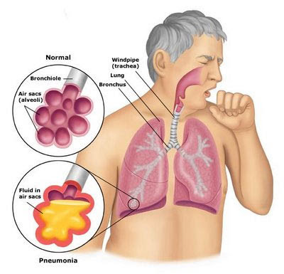 infected sinuses x ray