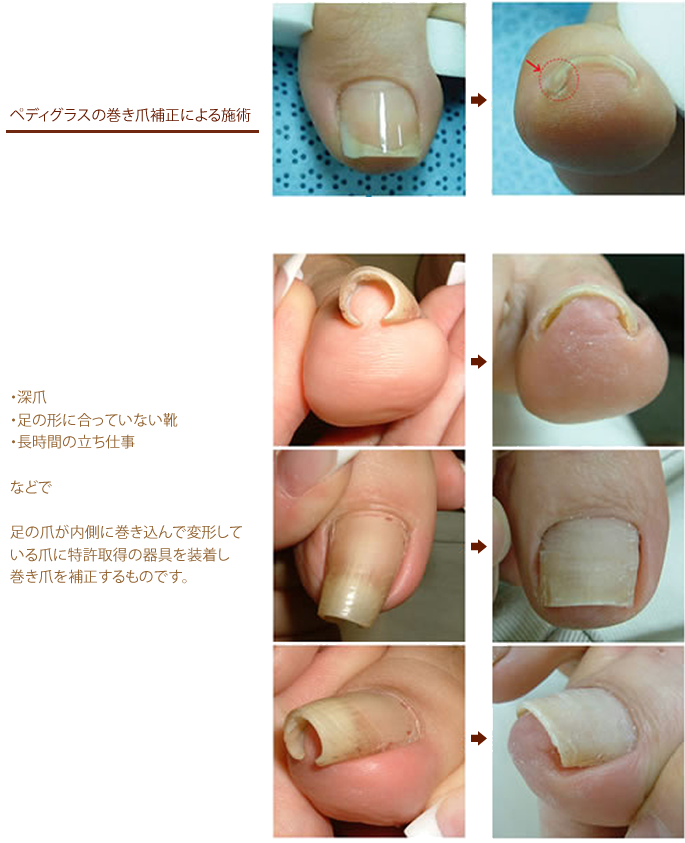 新潟のネイルサロンkunstylenailroom