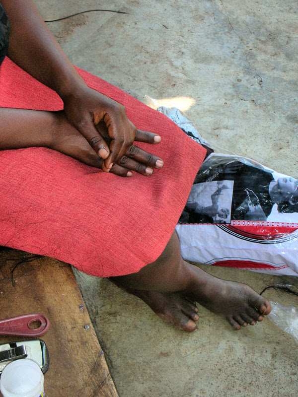 Skin Bleaching Thrives Despite Ugandan Government Ban on 