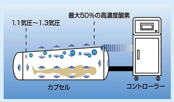 宇都宮市のほし整骨院 スポーツ外来 怪我 治療 高気圧酸素カプセルについて