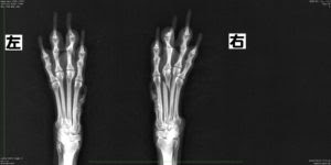 整形 中手骨骨折 横浜もみじ動物病院 都筑区仲町台 犬猫 鍼灸 漢方 ペットホテル