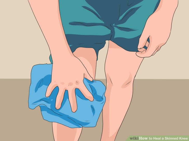 Heal a Skinned Knee Step 7 Version 4.jpg