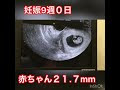 【印刷可能】 赤ちゃん 9週目 181848-9週目 赤ちゃん 動く