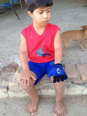 Victor Soares sofre de polidactilia e tem 26 dedos, em Abadia de Goiás (Foto: Humberta Carvalho/G1)