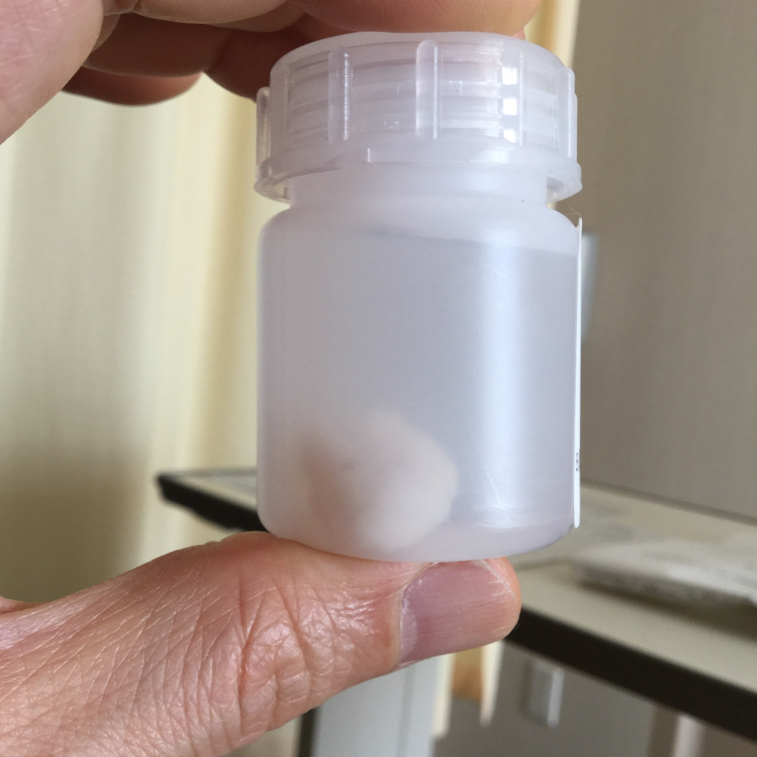 膝の手術 院長ブログ