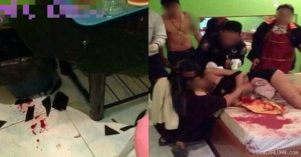 Vết thương của cô gái chảy khá nhiều máu. Ảnh: Mirror