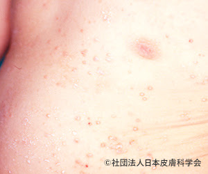 一般皮膚科 公式 浄水皮ふ科クリニック 福岡 薬院 の皮膚科 美容皮膚科 形成外科