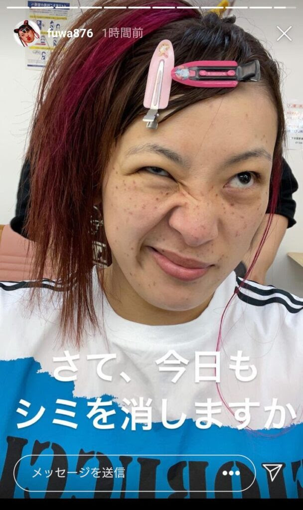 代芸能人すっぴんブスランキングワースト11 化粧しないと美人じゃない女優タレントモデルは誰 育児パパの手探り奮闘記