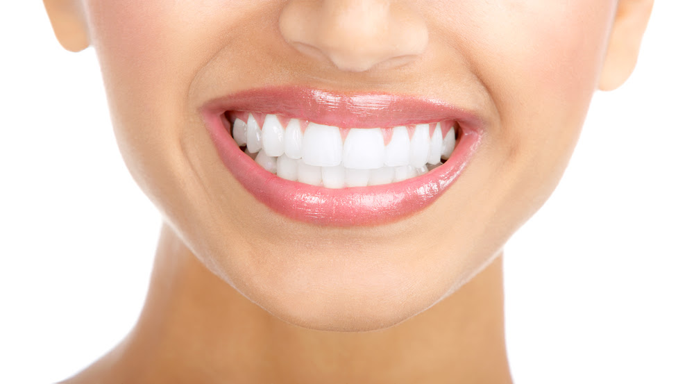 Teeth not white after bleaching