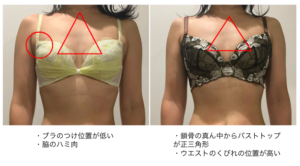 ブラジャーでみぞおちが苦しくなる原因とは すぐできる対処法も紹介 美容家ドットコム