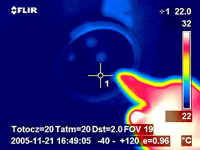 Hand: thermal imaging