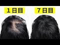 画像 フェヌグリーク 髪 148641-フェヌグリーク 髪