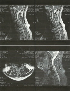 MRI August 2011