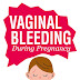Pictures Of Spotting During Pregnancy - I'm pregnant, freaking out about "spotting"?? Advice please!! - Approximately 20% of women report they experience spotting during their first 12 weeks of pregnancy.