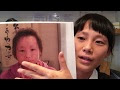 √画像をダウンロード アトピー 髪の毛抜ける 251616