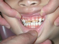 神戸市東灘区御影の徐小児歯科 日本小児歯科学会専門医 八木成徳