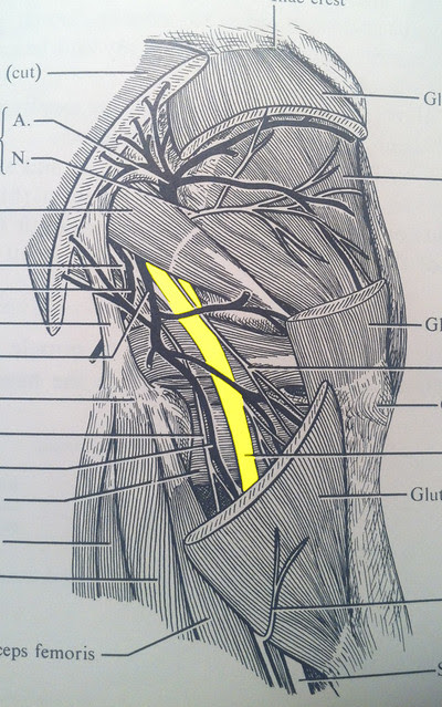 SCIATIC NERVE | Flickr - Photo Sharing!