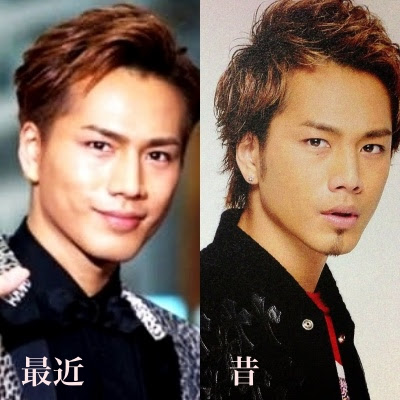 整形疑惑 三代目jsb登坂広臣が整形 昔と顔が違うとの声 顔の変化について徹底調査 三代目jsbなら三代目 J Soul Brothers最新情報局