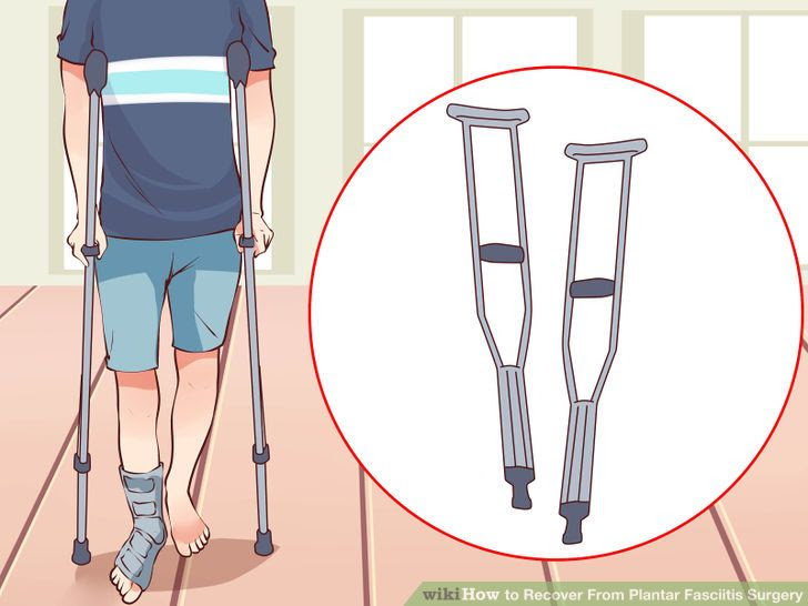 Recover From Plantar Fasciitis Surgery Step 9 Version 2.jpg