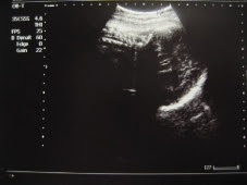 妊娠後期 36 39週 10ヶ月 エコー 妊娠 出産 育児 Maternity Baby Kids