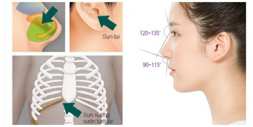 Mũi ngắn hếch là như thế nào và cách khắc phục hiệu quả