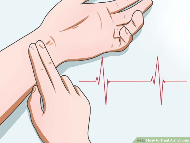Treat Arrhythmia Step 16 Version 2.jpg
