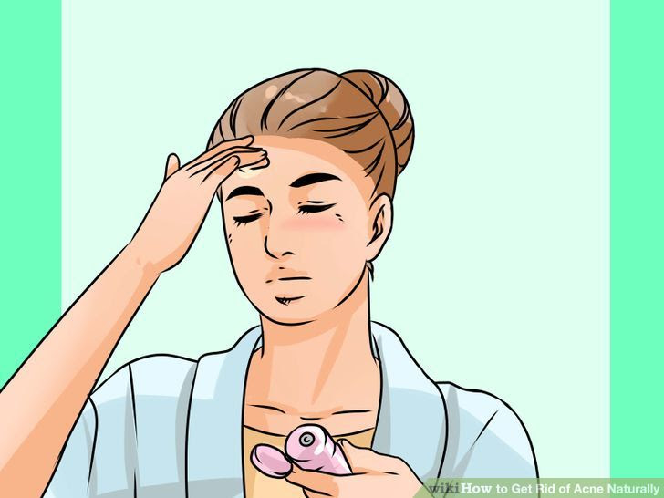 Get Rid of Acne Naturally Step 15.jpg
