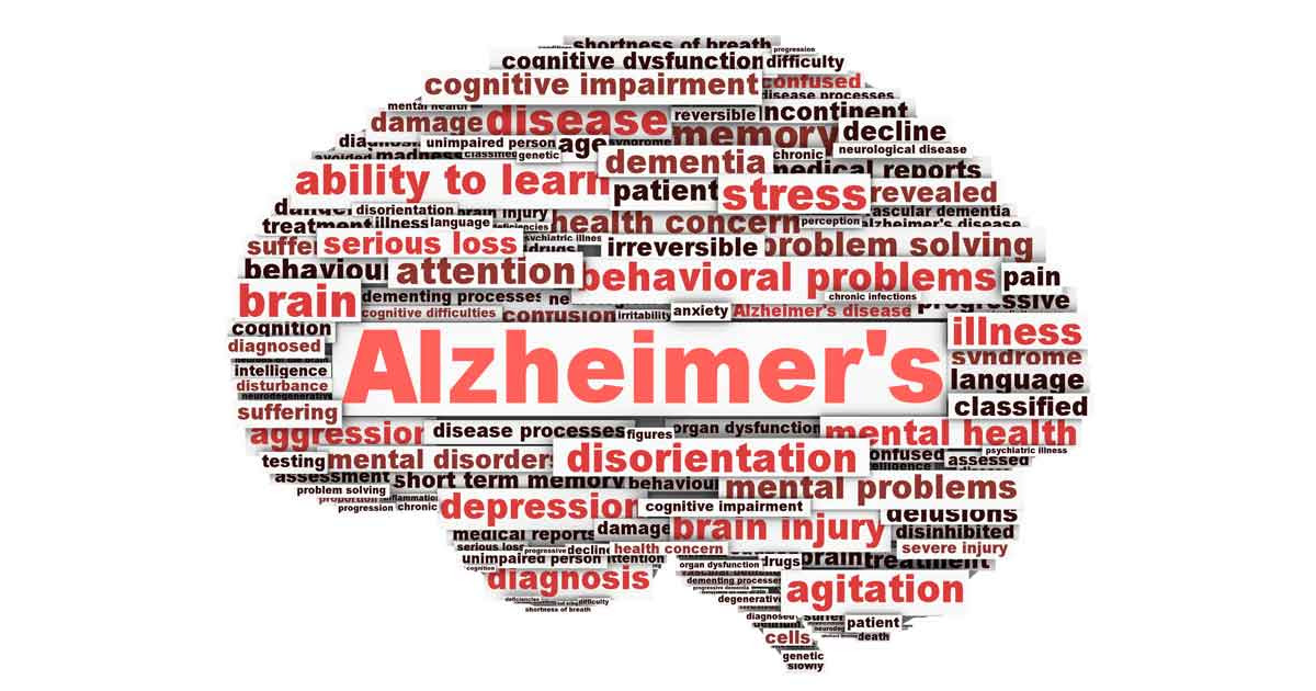 Image result for alzheimer's