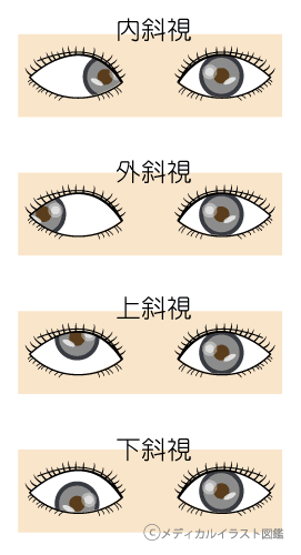 無料ダウンロード イラスト 目 種類 1840 イラスト 目 種類 集 Zonejpgazo