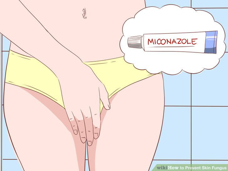 Prevent Skin Fungus Step 17.jpg