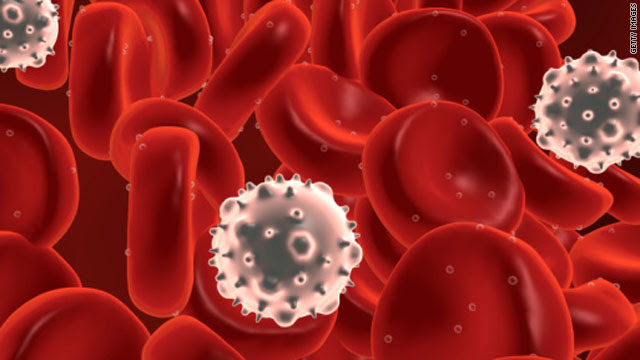 Acute myeloid leukemia Genetic and Rare Diseases