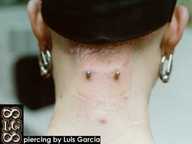 Nape piercing with 12ga 7/8" x 1/8" surface barbell.