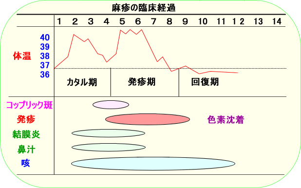１才になったら すぐ麻疹 風疹混合ワクチンを接種しましょう
