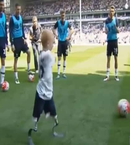 8yearoldamputee